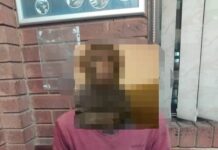 Centurion Residents Frustrated as Cable Theft Persists Despite Arrest